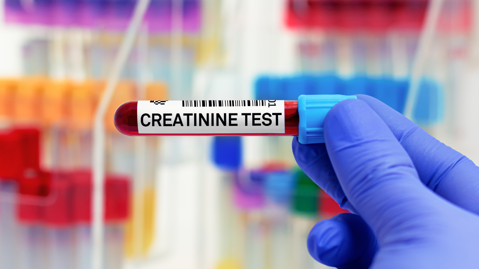 Creatinine Levels in Kidney Tests Crucial; High Levels May Indicate Kidney Issues