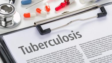 India needs innovative strategies to eliminate TB