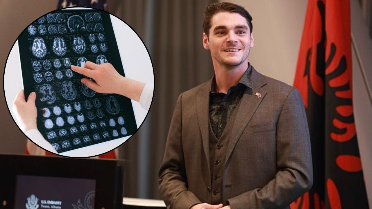 Breaking Bad Actor RJ Mitte Battled Cerebral Palsy: Symptoms and Treatment